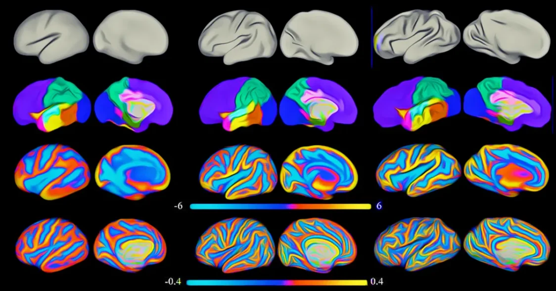 Newborn Brain Development