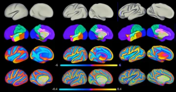 Newborn Brain Development